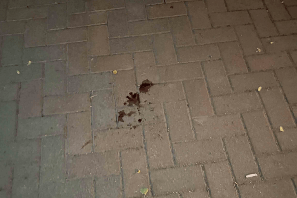 Blod på marken där misshandeln ägde rum. Foto: Polisen.